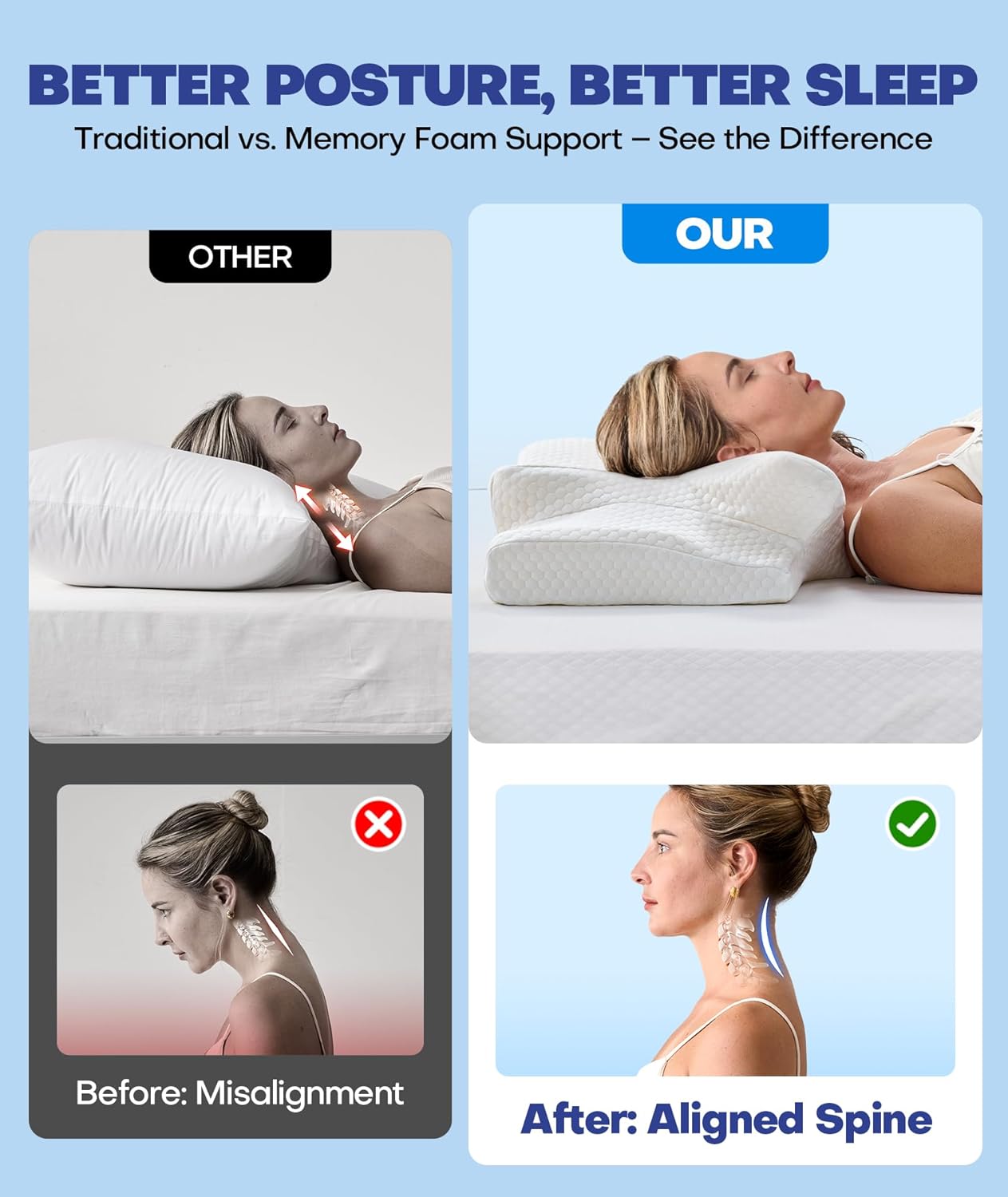 Emircey Clinical-Level Relief Cervical Neck Pillow for Sleeping, Orthopedic Contour Memory Foam Pillow for Side Sleepers, Cooling Pillow for Neck Relief, Ergonomic for Back and Stomach Sleepers